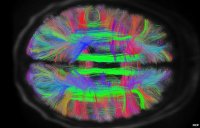 Axial view of the brain, via HCP
